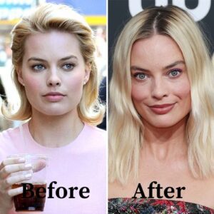 Margot Robbie’s Nose Transformation: Unveiling The Refined Beauty Plastic Surgery